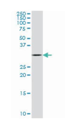 CD8a molecule, Mouse, Polyclonal Antibody, Abnova&trade;