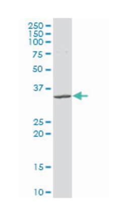 CD8a molecule, Mouse, Polyclonal Antibody, Abnova&trade;