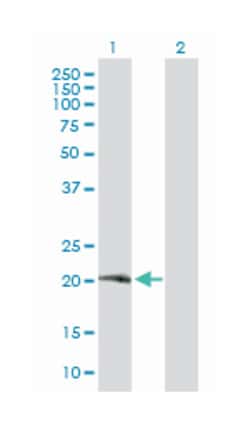 CD8a molecule, Rabbit, Purified MaxPab Polyclonal Antibody, Abnova 100&mu;g;