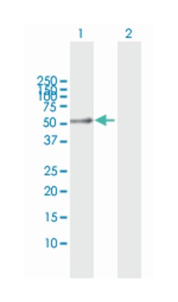 CD14, Rabbit, MaxPab Polyclonal Antibody, Abnova 100&mu;L; Unlabeled:Antibodies,