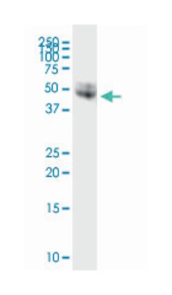 CD14, Rabbit, MaxPab Polyclonal Antibody, Abnova 100&mu;L; Unlabeled:Antibodies,