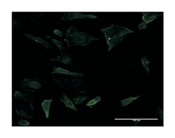 CD19, Mouse, Clone: 1C9, Abnova 100&mu;g; Unlabeled:Antibodies, Monoclonal