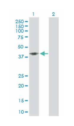 CD58 molecule, Rabbit, Purified MaxPab Polyclonal Antibody, Abnova 100&mu;g;