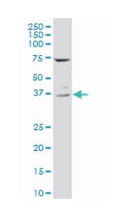 CD68 molecule, Mouse, Polyclonal Antibody, Abnova 50&mu;L; Unlabeled:Antibodies,