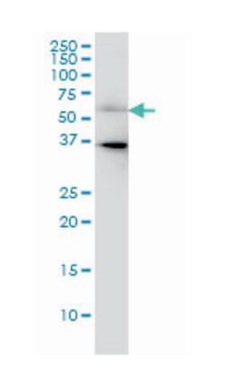 CDC25C, Mouse, Clone: 3B11, Abnova 200&mu;L; Unlabeled:Antibodies, Monoclonal