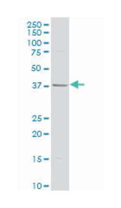 cyclin-dependent kinase 7, Mouse, Polyclonal Antibody, Abnova&trade;