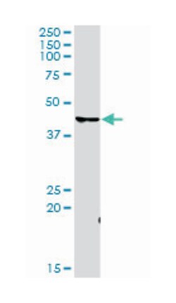 cyclin-dependent kinase 7, Rabbit, Purified MaxPab Polyclonal Antibody,
