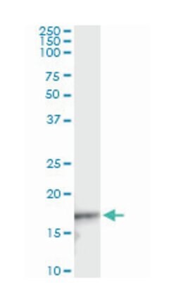 CDKN2D, Mouse, Clone: 2E10, Abnova 100&mu;g; Unlabeled:Antibodies, Monoclonal
