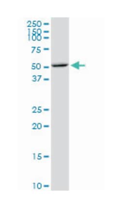 CDS1, Mouse, Clone: 2D10, Abnova 100 &mu;g | Buy Online | Abnova Corporation | Fisher Scientific