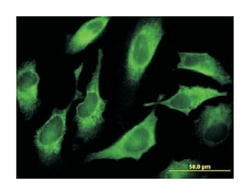 CDS1, Mouse, Clone: 2D10, Abnova 100 &mu;g | Buy Online | Abnova Corporation | Fisher Scientific