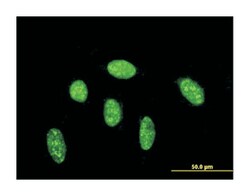 CDX1, Mouse, Clone: 3C5, Abnova 100&mu;g; Unlabeled:Antibodies, Monoclonal