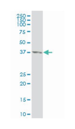CDX4, Mouse, Clone: 1E9, Abnova 100 &mu;g | Buy Online | Abnova | Fisher Scientific