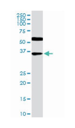 CDX4, Mouse, Clone: 1E9, Abnova 100 &mu;g | Buy Online | Abnova | Fisher Scientific