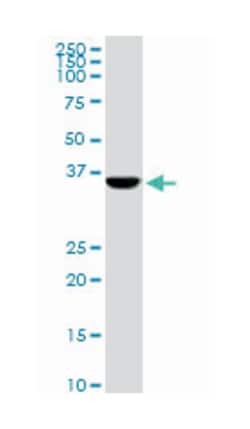 CDX4, Mouse, Clone: 1E9, Abnova 100 &mu;g | Buy Online | Abnova | Fisher Scientific