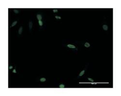 CDX4, Mouse, Clone: 1E9, Abnova 100 &mu;g | Buy Online | Abnova | Fisher Scientific