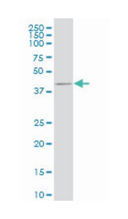 CDX4, Mouse, Clone: 1E11, Abnova 100&mu;g; Unlabeled:Antibodies, Monoclonal