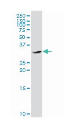 CCAAT/enhancer binding protein (C/EBP), epsilon, Mouse, Polyclonal Antibody, Abnova 50 &mu;L | Buy Online | Abnova Corporation | Fisher Scientific
