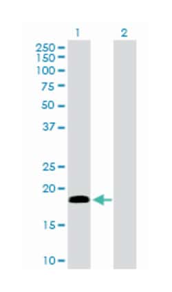 centrin, EF-hand protein, 1, Rabbit, Purified MaxPab Polyclonal Antibody,