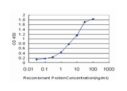 CETN2, Mouse, Clone: 3F8, Abnova 100 &mu;g | Buy Online | Abnova Corporation | Fisher Scientific