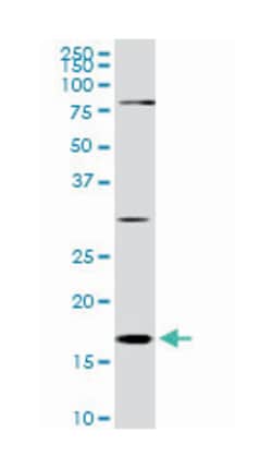 cofilin 1 (nonmuscle), Mouse, Clone: 1A1, Abnova 100&mu;g; Unlabeled:Antibodies,