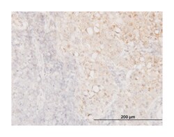 cofilin 1 (nonmuscle), Mouse, Clone: 1A1, Abnova 100&mu;g; Unlabeled:Antibodies,