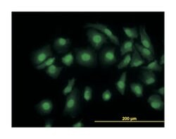 cofilin 1 (nonmuscle), Mouse, Clone: 1A1, Abnova 100&mu;g; Unlabeled:Antibodies,