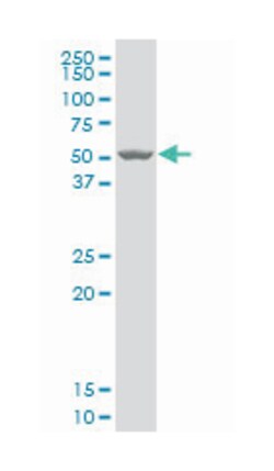 chondroadherin, Mouse, Polyclonal Antibody, Abnova&trade;
