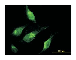 CHD1 (M04), Mouse anti-Human, Clone: 1G2, Abnova 100&mu;g; Unlabeled:Antibodies,