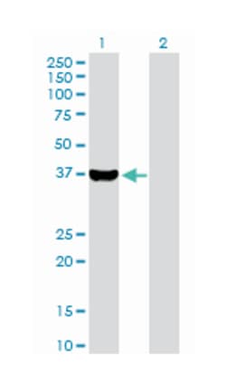 aldo-keto reductase family 1, member C4 (chlordecone reductase; 3-alpha