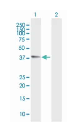 chitinase 3-like 1 (cartilage glycoprotein-39), Mouse, Purified MaxPab