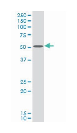 choline kinase alpha (A01), Mouse anti-Human, Polyclonal Antibody, Abnova&trade;
