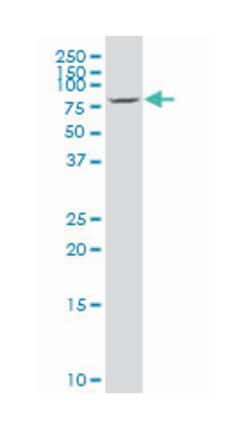 choroideremia-like (Rab escort protein 2) (A01), Mouse anti-Human, Polyclonal Antibody, Abnova 50 &mu;L | Buy Online | Abnova | Fisher Scientific