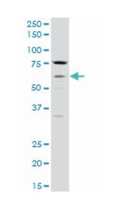 cholinergic receptor, muscarinic 3, Mouse, Polyclonal Antibody, Abnova&trade;