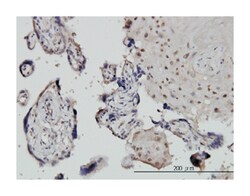 conserved helix-loop-helix ubiquitous kinase, Mouse, Clone: 2G4, Abnova
