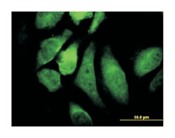 conserved helix-loop-helix ubiquitous kinase, Mouse, Clone: 2G4, Abnova
