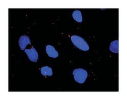 conserved helix-loop-helix ubiquitous kinase, Mouse, Clone: 2G4, Abnova