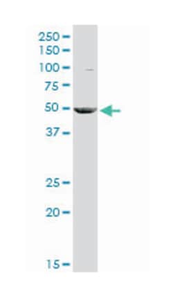 creatine kinase, muscle, Rabbit, Purified MaxPab Polyclonal Antibody, Abnova 100 &mu;g | Buy Online | Abnova Corporation | Fisher Scientific