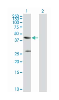 creatine kinase, muscle, Rabbit, Purified MaxPab Polyclonal Antibody, Abnova 100 &mu;g | Buy Online | Abnova Corporation | Fisher Scientific