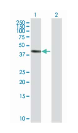 excision repair cross-complementing rodent repair deficiency, complementation group 8, Rabbit, Purified MaxPab Polyclonal Antibody, Abnova 100 &mu;g | Buy Online | Abnova Corporation | Fisher Scientific