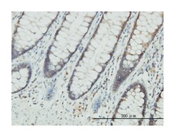 CLIC1 (M01), Mouse anti-Human, Clone: 2D4, Abnova 100&mu;g; Unlabeled:Antibodies,