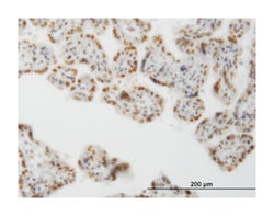 CLK3, Mouse, Clone: 1H2, Abnova 100&mu;g; Unlabeled:Anticuerpos