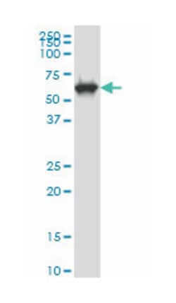 CLK3, Mouse, Clone: 5B2, Abnova 100&mu;g; Unlabeled:Antibodies, Monoclonal