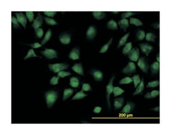 CLK3, Mouse, Clone: 5B2, Abnova 100&mu;g; Unlabeled:Antibodies, Monoclonal