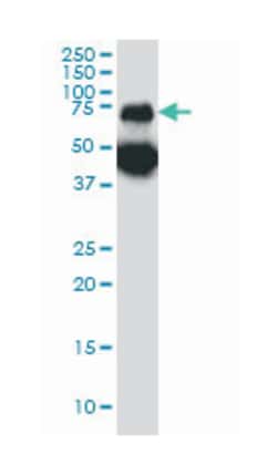 TPP1, Mouse, Clone: 3B1, Abnova 100&mu;g; Unlabeled:Antibodies, Monoclonal