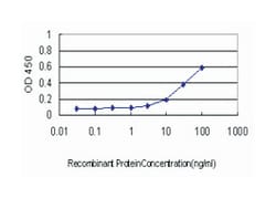 TPP1, Mouse, Clone: 3B1, Abnova 100&mu;g; Unlabeled:Antibodies, Monoclonal