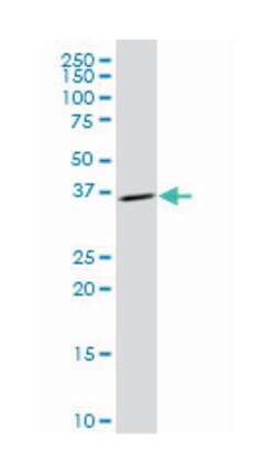 calponin 3, acidic, Mouse, Polyclonal Antibody, Abnova 50&mu;L; Unlabeled:Antibodies,