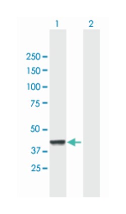 CNP, Mouse, Purified MaxPab Polyclonal Antibody, Abnova 50 &mu;g | Buy Online | Abnova Corporation | Fisher Scientific