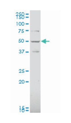 cannabinoid receptor 1 (brain), Mouse, Polyclonal Antibody, Abnova 50&mu;L;