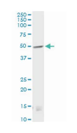 CNR1, Mouse, Clone: 2F9, Abnova 100 &mu;g | Buy Online | Abnova | Fisher Scientific