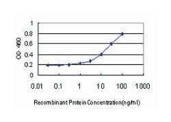 COL4A6, Mouse, Clone: 1G11, Abnova 100&mu;g; Unlabeled:Anticuerpos